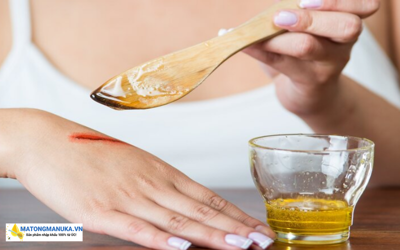 Mật ong manuka có tác dụng gì