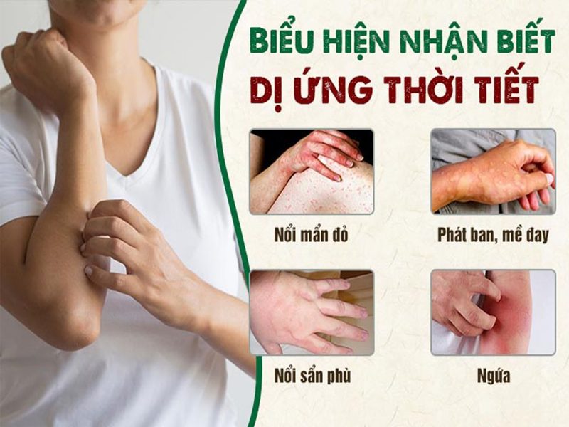  dị ứng thời tiết 