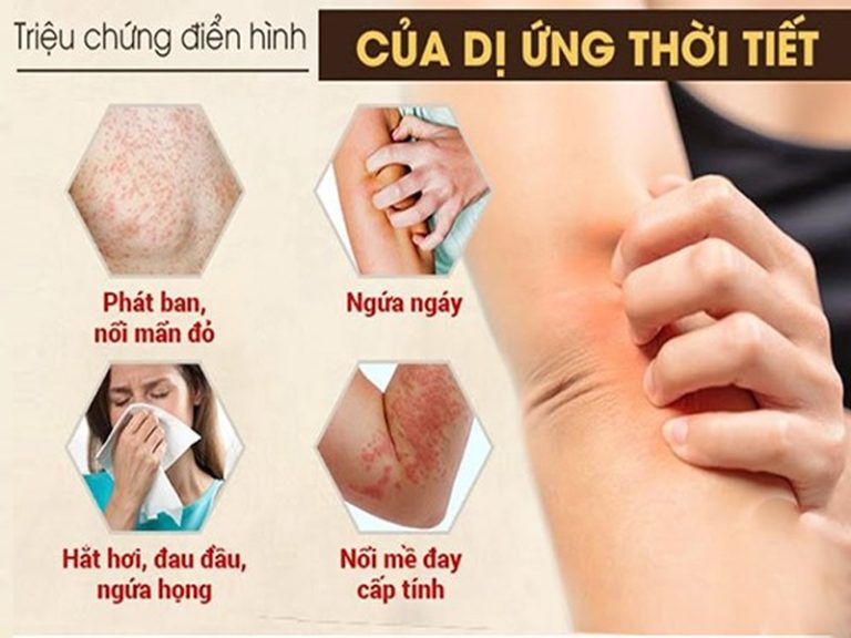 dị ứng thời tiết