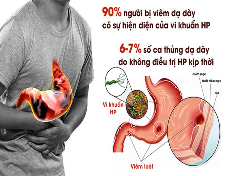 vi khuẩn hp là gì 