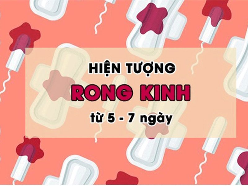 rong kinh la gi5