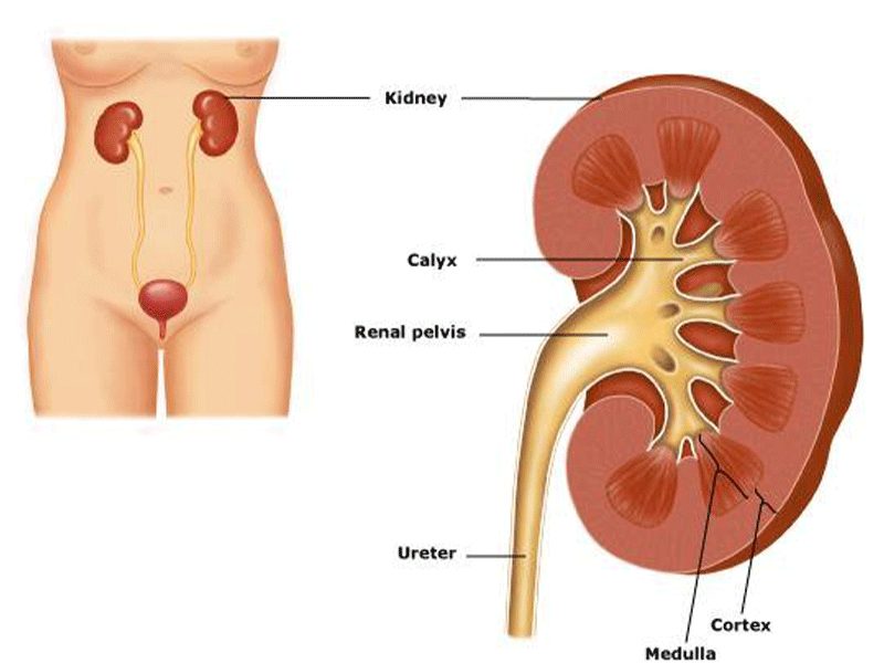 thận ứ nước